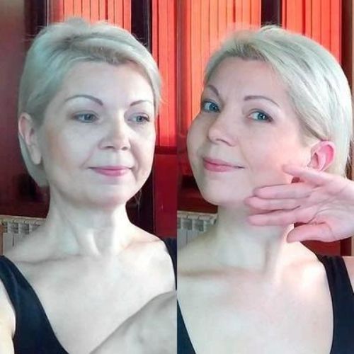 Pack 5 Mascarillas Reafirmantes de Mentón | Hidrogel Tensor | Lifting Facial
